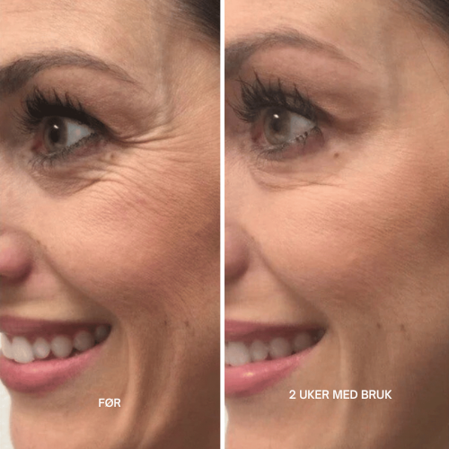 Clarivelle™ Det neste generasjons alternativet til retinol